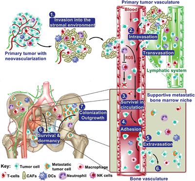 Endoplasmic Reticulum Stress in Bone Metastases